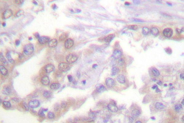 a12477t3 hist1h3a primary antiboties ihc testing 2