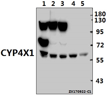Western blot (WB) analysis of CYP4X1 (V273) pAb at 1:1000 dilution
Lane1:CT26 whole cell lysate(40ug)
Lane2:H9C2 whole cell lysate(40ug)
Lane3:Hela whole cell lysate(40ug)
Lane4:HEK293T whole cell lysate(40ug)
Lane5:K562 whole cell lysate(40ug)