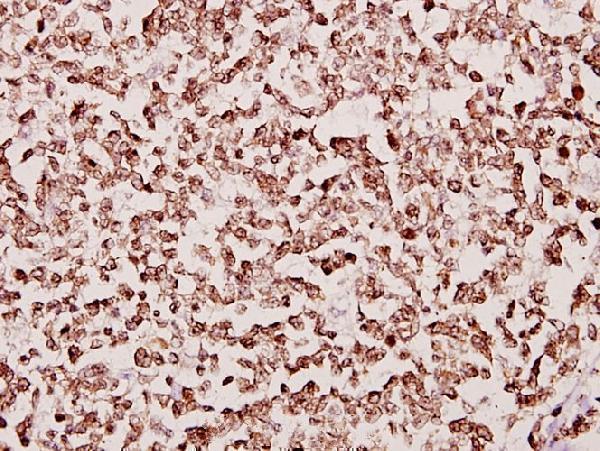 a12489 1 taf6l primary antiboties ihc testing 2