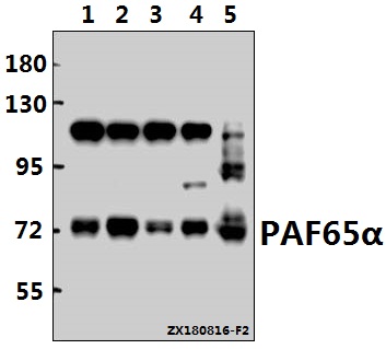 a12489 1 taf6l primary antiboties wb testing 1