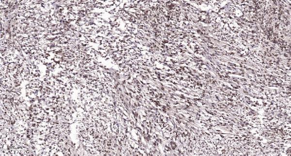 a12489 taf6l primary antibodies ihc testing 1