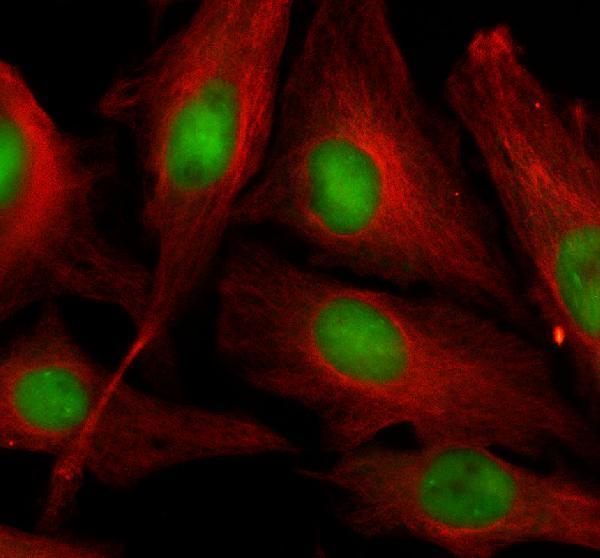 a12493 1 ddx31 primary antibodies if testing 1