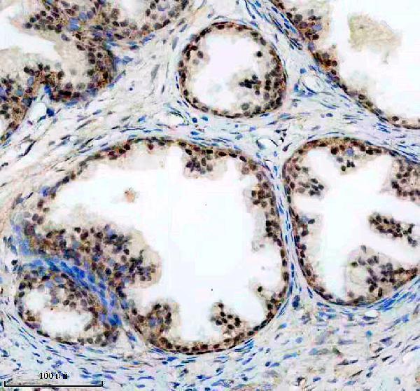 a12493 1 ddx31 primary antibodies ihc testing 1