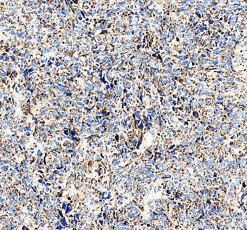 IHC analysis of KLHL22 using anti-KLHL22 antibody (A12497-3)