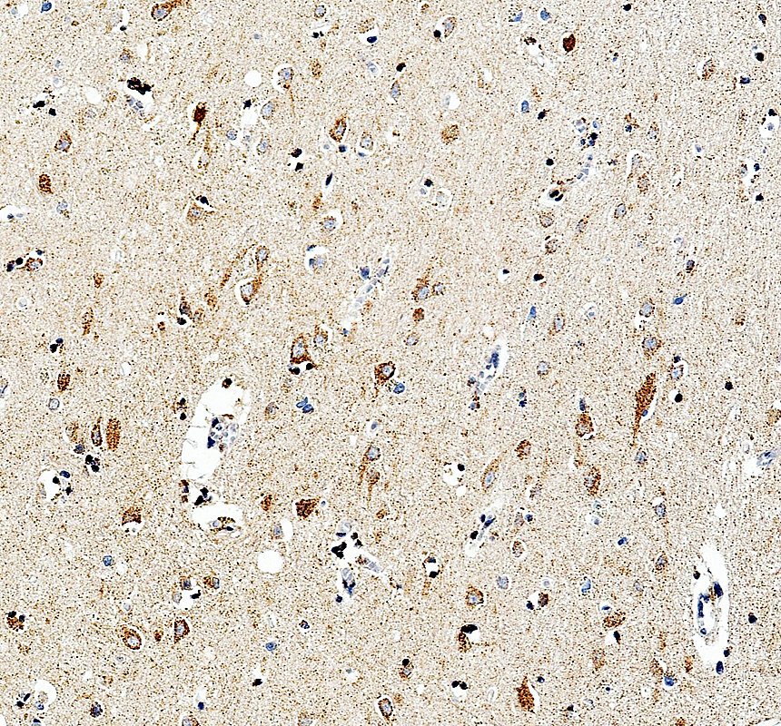 IHC analysis of KLHL22 using anti-KLHL22 antibody (A12497-3)