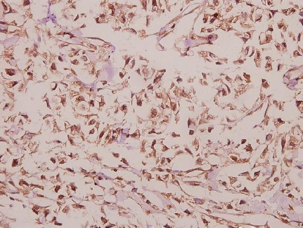 a12500 1 arrdc4 primary antiboties ihc testing 2
