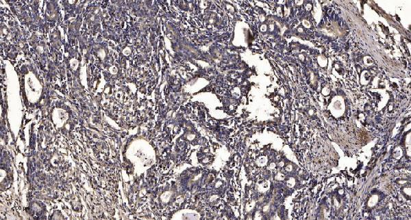 a12500 arrdc4 primary antibodies ihc testing 1