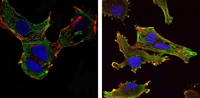 a12505 klhl13 primary antibodies if testing 4