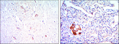 a12505 klhl13 primary antibodies ihc testing 3