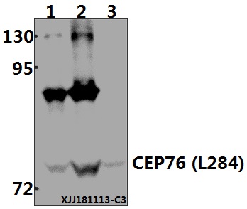 a12507 1 cep76 primary antiboties wb testing 1