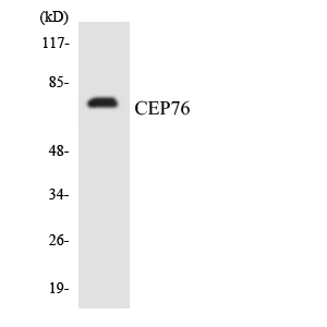 Western blot analysis of the lysates from HT-29 cells using CEP76 antibody