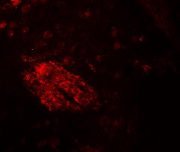 Immunofluorescence of WDR61 in mouse brain tissue with WDR61 antibody at 20 μg/ml