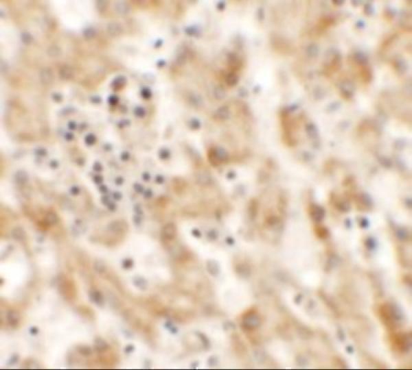 Immunohistochemistry of NKX2-8 in human liver tissue with NKX2-8 antibody at 2