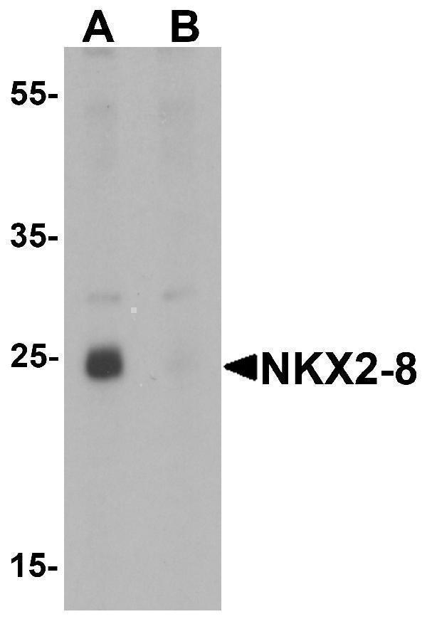 Western blot analysis of NKX2-8 in rat liver tissue lysate with NKX2-8 antibody at 1 μg/mL in (A) the absence and (B) the presence of blocking peptide
