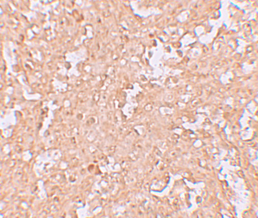 Immunohistochemistry of ZBTB8 in human spleen tissue with ZBTB9 antibody at 2