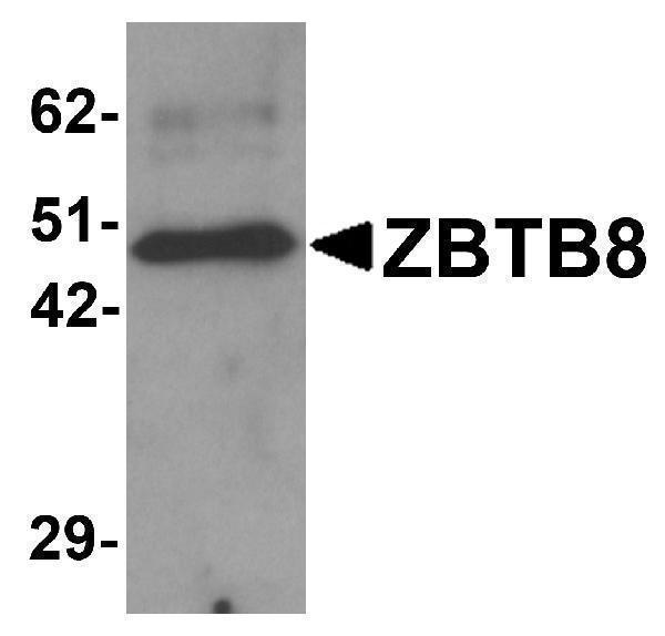 Western blot analysis of ZBTB8 in mouse spleen tissue lysate with ZBTB8 antibody at 1 μg/mL