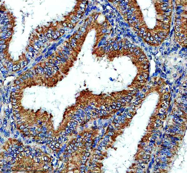 a12537 tmed3 primary antibodies ihc testing 1