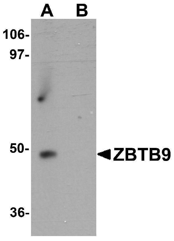 a12548 zbtb9 primary antibodies wb testing 1