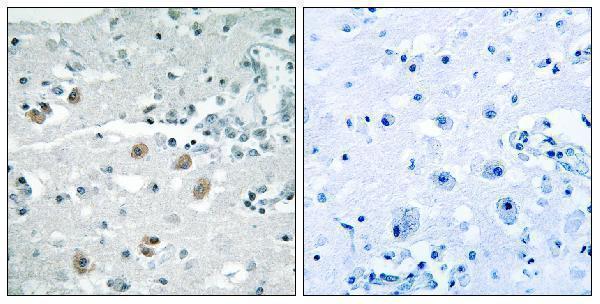 Immunohistochemistry analysis of paraffin-embedded human brain, using PLA2G4D Antibody