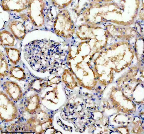 IHC analysis of TRIM10 using anti-TRIM10 antibody (A12560-3)