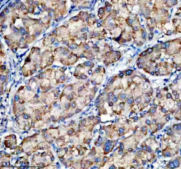 IHC analysis of TRIM10 using anti-TRIM10 antibody (A12560-3)