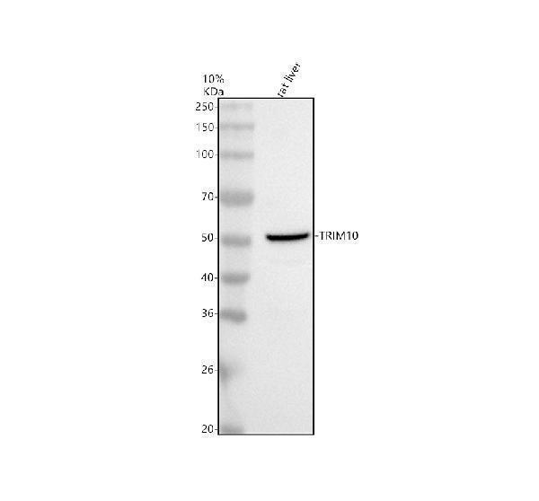 Western blot analysis of TRIM10 using anti-TRIM10 antibody (A12560-3)