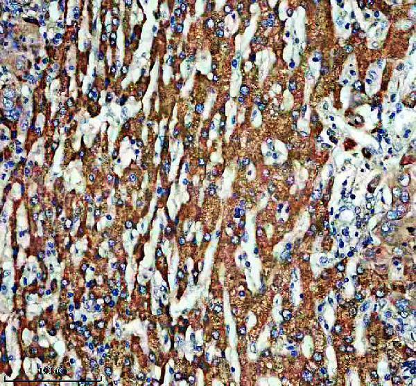 a12563 dctn5 primary antibodies ihc testing 1