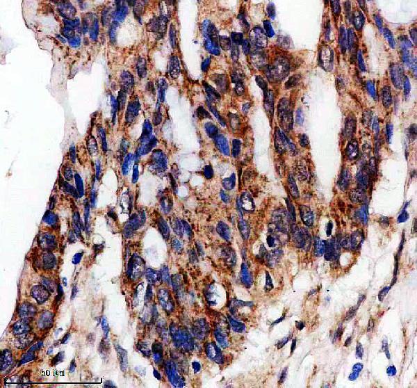 a12563 dctn5 primary antibodies ihc testing 2
