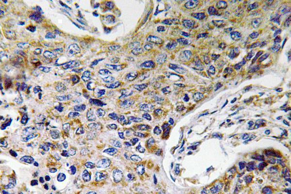 a12564 atp5j2 primary antibodies ihc testing 1