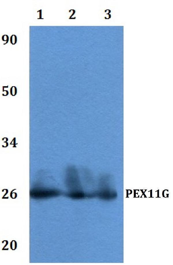 Western blot (WB) analysis of PEX11G polyclonal antibody at 1:500 dilution 
Line1:Mcf-7 whole cell lysate
Line2:PC12 whole cell lysate
Line3:sp20 whole cell lysate