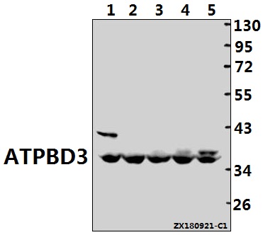 Western blot (WB) analysis of ATPBD3 (G318) polyclonal antibody at 1:500 dilution
Lane1:CT26 whole cell lysate(40ug)
Lane2:PC12 whole cell lysate(40ug)
Lane3:A375 whole cell lysate(40ug)
Lane4:HEK293T whole cell lysate(40ug)
Lane5:HCT116 whole cell lysate(40ug)