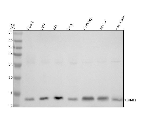 Western blot analysis of TIMM8B using anti-TIMM8B antibody (A12570-1)