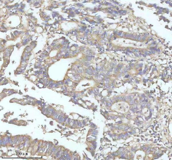 IHC analysis of DENND2D using anti-DENND2D antibody (A12572-2)