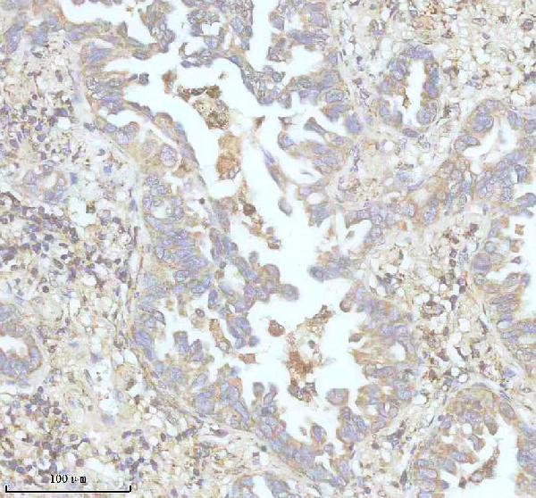 IHC analysis of DENND2D using anti-DENND2D antibody (A12572-2)