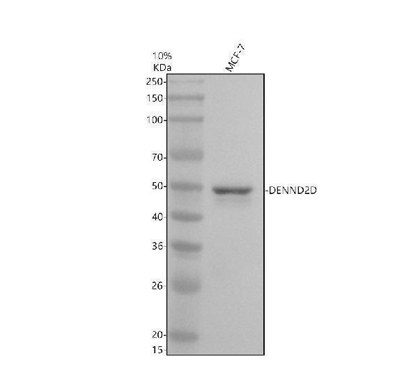 Western blot analysis of DENND2D using anti-DENND2D antibody (A12572-2)