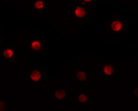 a12575 1 n4bp1 primary antibodies if testing 3