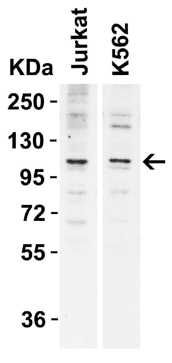 a12575 1 n4bp1 primary antibodies wb testing 1