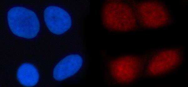 Figure 2. IF analysis of N4BP1 using anti-N4BP1 antibody (A12575-3). N4BP1 was detected in an immunocytochemical section of HELA cells. Enzyme antigen retrieval was performed using IHC enzyme antigen retrieval reagent (AR0022) for 15 mins. The cells were blocked with 10% goat serum. And then incubated with 5 microg/mL rabbit anti-N4BP1 Antibody (A12575-3) overnight at 4°C. Cy3 Conjugated Goat Anti-Rabbit IgG (BA1032) was used as secondary antibody at 1:500 dilution and incubated for 30 minutes at 37°C. The section was counterstained with DAPI. Visualize using a fluorescence microscope and filter sets appropriate for the label used.