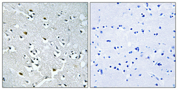 a12575 n4bp1 primary antibodies ihc testing 1