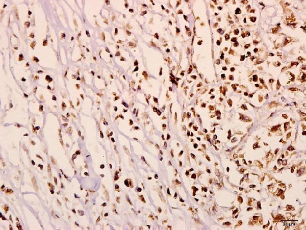 a12575y415 n4bp1 primary antiboties ihc testing 2