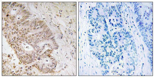 a12580 znf592 primary antibodies ihc testing 1