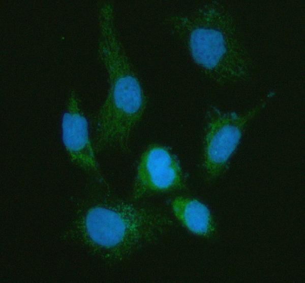 Figure 2. IF analysis of MFAP3L using anti-MFAP3L antibody (A12581). MFAP3L was detected in an immunocytochemical section of HELA cells. Enzyme antigen retrieval was performed using IHC enzyme antigen retrieval reagent (AR0022) for 15 mins. The cells were blocked with 10% goat serum. And then incubated with 5 microg/mL rabbit anti-MFAP3L Antibody (A12581) overnight at 4°C. DyLight®488 Conjugated Goat Anti-Rabbit IgG (BA1127) was used as secondary antibody at 1:500 dilution and incubated for 30 minutes at 37°C. The section was counterstained with DAPI. Visualize using a fluorescence microscope and filter sets appropriate for the label used.