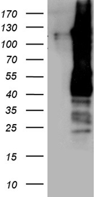 a12592 1 anti saps2 ppp6r2 rabbit polyclonal antibody wb testing 1