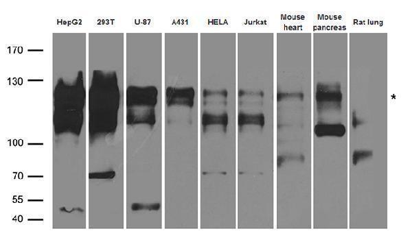 a12592 1 anti saps2 ppp6r2 rabbit polyclonal antibody wb testing 2