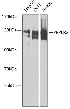 a12592 ppp6r2 primary antiboties wb testing 1