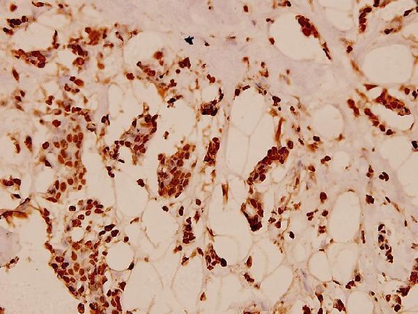 a12594 1 h2bfs primary antiboties ihc testing 2