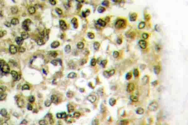 a12594 2 h2bfs primary antiboties ihc testing 2