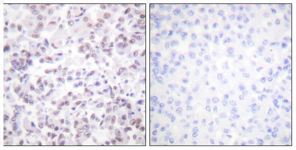 a12594 h2bfs primary antibodies ihc testing 3