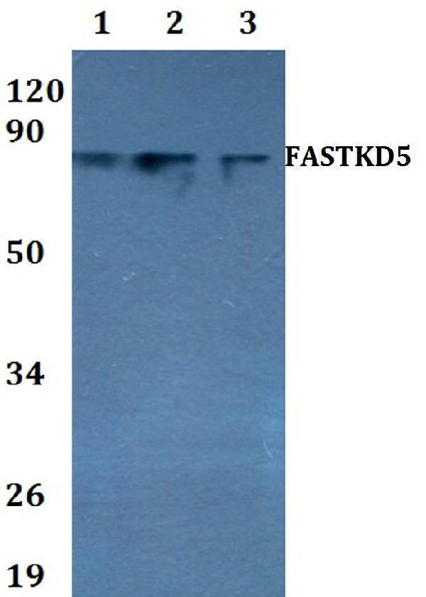 Western blot (WB) analysis of FASTKD5 polyclonal antibody at 1:500 dilution
Lane1:HEK293T whole cell lysate
Lane2:sp2/0 whole cell lysate 
Lane3:PC12 whole cell lysate 