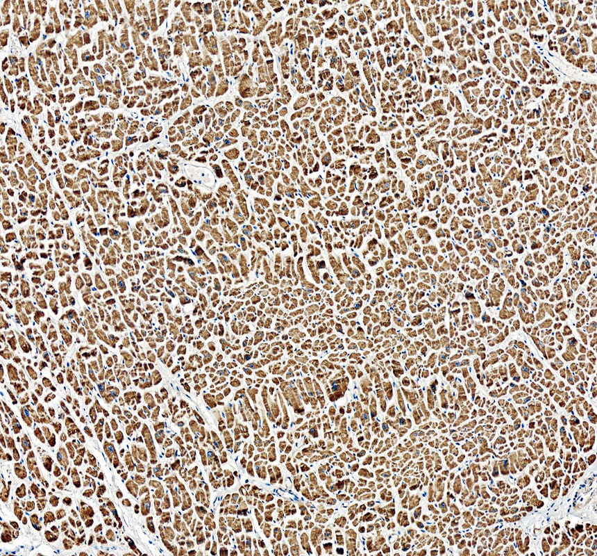 IHC analysis of NDUFA11 using anti-NDUFA11 antibody (A12604-1)